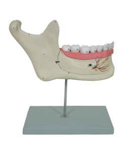 Jaw Model, Lower 3X Mag 6 Pc.
