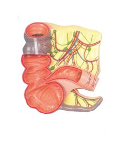 Appendix and Caecum 2X Mag. Relief Model.