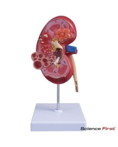 Kidney Model, Natural Size, 2 Pc.